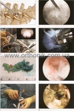 Foraminoscopy10.jpg