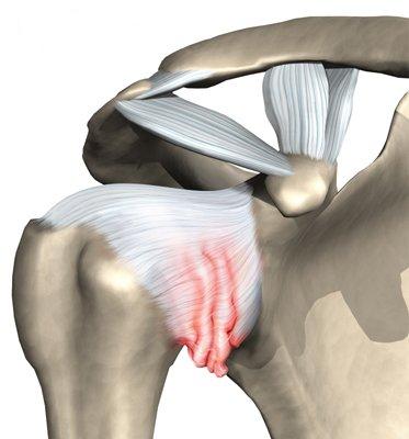 Arthroscopy of the shoulder joint4.jpg