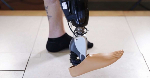 orthonik_bionic_foot.jpg