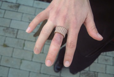 Косметический протез пальца кисти