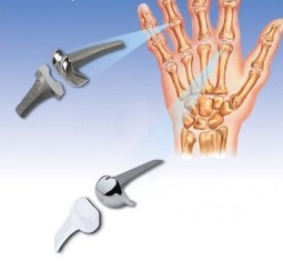 Еndoprosthesis of joints of hand